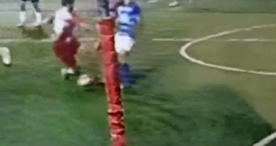 ACL Healing without surgery – Healed Case 27